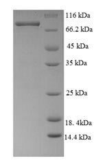 Recombinant Human Desmoglein-3(DSG3),partial