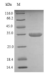 Recombinant Human Dickkopf-related protein 1(DKK1),partial