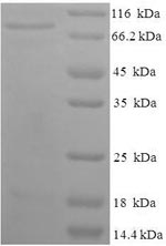 Recombinant Human Dihydropyrimidinase-related protein 1(CRMP1)