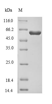 Recombinant Human Dihydropyrimidinase-related protein 1(CRMP1)