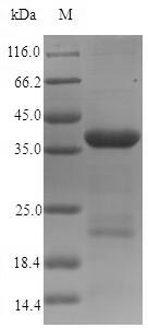 Recombinant Human Dystonin (DST),partial