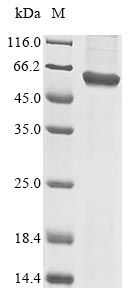 Recombinant Human E3 ubiquitin-protein ligase TRAIP(TRAIP)