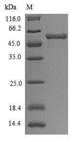 Recombinant Human E3 ubiquitin-protein ligase TRAIP(TRAIP)