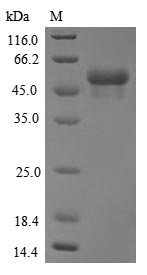 Recombinant Human E3 ubiquitin-protein ligase TRIM21(TRIM21)