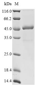 Recombinant Human E3 ubiquitin-protein ligase TRIM63(TRIM63)