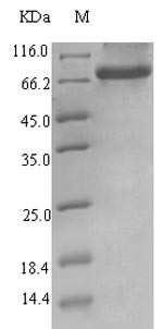 Recombinant Human Endogenous retrovirus group K member 6 Env polyprotein(ERVK-6),partial