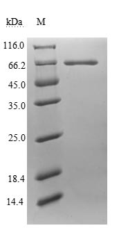 Recombinant Human Endogenous retrovirus group K member 6 Env polyprotein(ERVK-6),partial