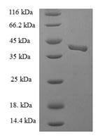 Recombinant Human Endothelial cell-selective adhesion molecule(ESAM),partial