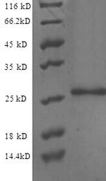 Recombinant Human Endothelial protein C receptor(PROCR) ,partial