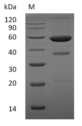 Recombinant Human Ephrin-A1(EFNA1) (Active)
