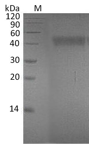 Recombinant Human Ephrin-A4(EFNA4),partial (Active)