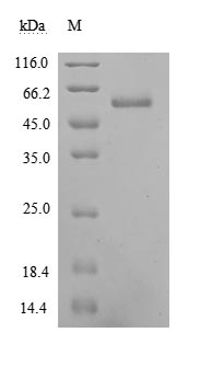 Recombinant Human Ephrin-A5(EFNA5) (Active)