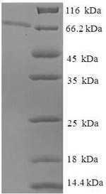 Recombinant Human Epoxide hydrolase 1(EPHX1)