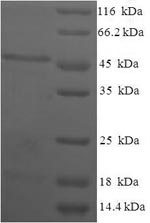 Recombinant Human Estradiol 17-beta-dehydrogenase 11(HSD17B11)