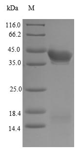 Recombinant Human Estrogen receptor beta(ESR2),partial