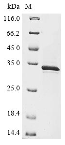 Recombinant Human Extracellular serine/threonine protein kinase FAM20C(FAM20C),partial