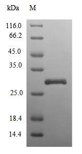 Recombinant Human Extracellular superoxide dismutase [Cu-Zn](SOD3)