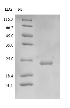 Recombinant Human Extracellular superoxide dismutase [Cu-Zn](SOD3)