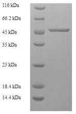 Recombinant Human F-actin-capping protein subunit alpha-2(CAPZA2)
