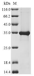 Recombinant Human F-box only protein 44(FBXO44)