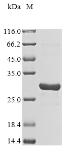 Recombinant Human F-box only protein 48(FBXO48)