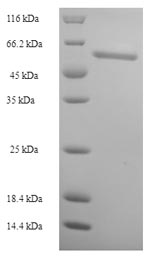 Recombinant Human FAD synthase(FLAD1)