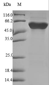Recombinant Human Fibrinogen beta chain(FGB), partial