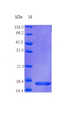 Recombinant Human Fibroblast growth factor 1 protein(FGF1) (Active)
