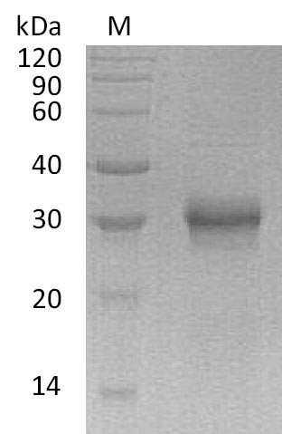 Recombinant Human Fibroblast growth factor 17(FGF17) (Active)