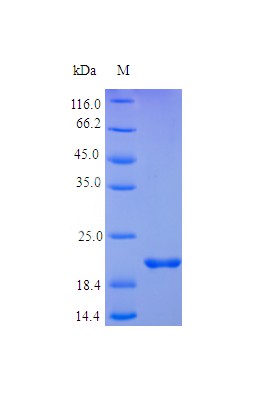 Recombinant Human Fibroblast growth factor 17 protein(FGF17) (Active)