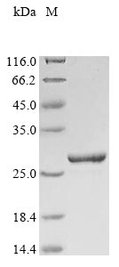 Recombinant Human Fibroblast growth factor 18(FGF18)