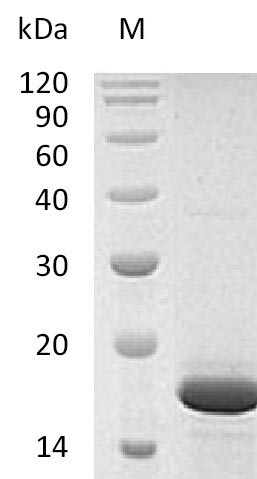 Recombinant Human Fibroblast growth factor 2(FGF2) (Active)