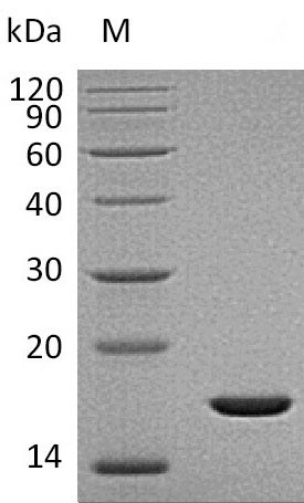 Recombinant Human Fibroblast growth factor 2(FGF2),partial (Active)