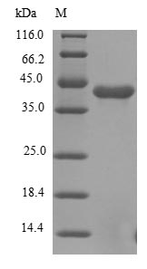 Recombinant Human Fibroblast growth factor receptor 1(FGFR1),partial