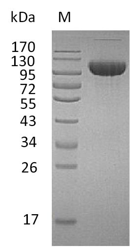 Recombinant Human Fibroblast growth factor receptor 3(FGFR3),partial (Active)