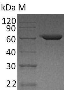 Recombinant Human Fibronectin(FN1),partial (Active)