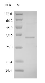 Recombinant Human Fibronectin type III domain-containing protein 5(FNDC5),partial