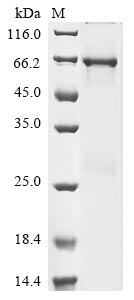 Recombinant Human Flt3-interacting zinc finger protein 1(FIZ1)