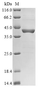 Recombinant Human Forkhead box protein M1(FOxM1),partial