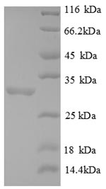 Recombinant Human Forkhead box protein P3(FOXP3),partial