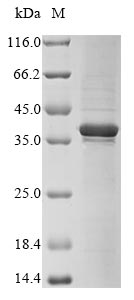 Recombinant Human Four and a half LIM domains protein 1(FHL1)