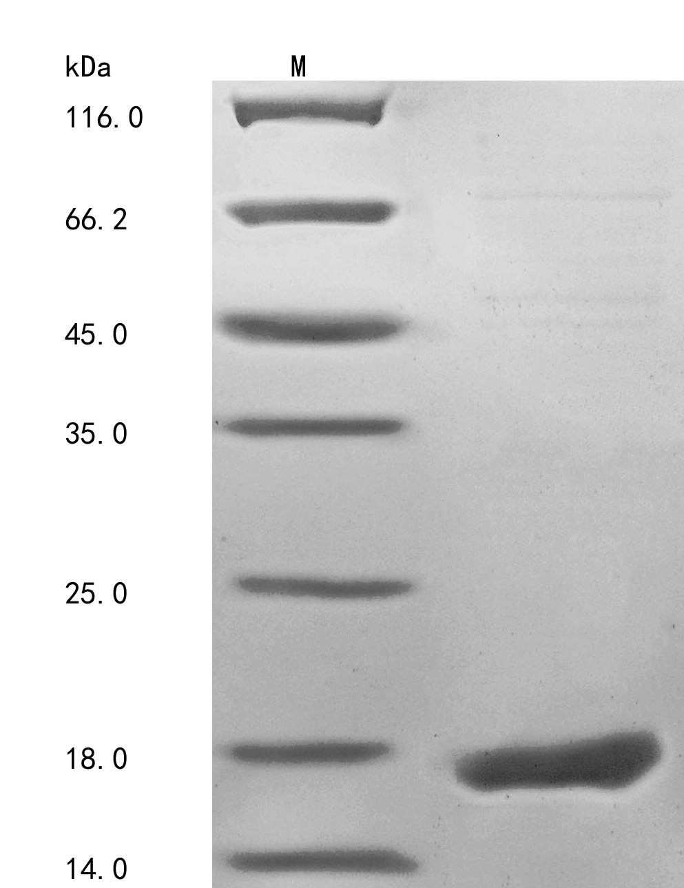 Recombinant Human Fragile X mental retardation 1 neighbor protein(FMR1NB),partial