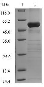 Recombinant Human Fructose-1,6-bisphosphatase 1(FBP1)
