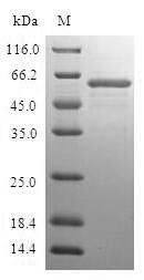 Recombinant Human Fructose-1,6-bisphosphatase 1(FBP1)