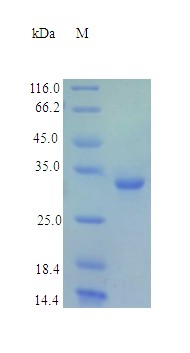 Recombinant Human Fructose-2,6-bisphosphatase TIGAR protein(TIGAR) (Active)