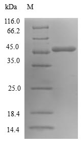 Recombinant Human GTP-binding protein SAR1a(SAR1A)