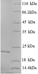 Recombinant Human GTPase KRas(KRAS),partial