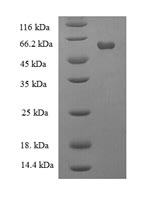 Recombinant Human Galactose-1-phosphate uridylyltransferase(GALT)