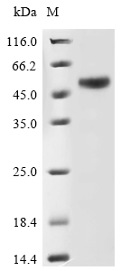 Recombinant Human Galactose-3-O-sulfotransferase 3(GAL3ST3),partial