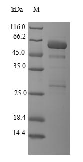 Recombinant Human Galectin-8(LGALS8) (Active)